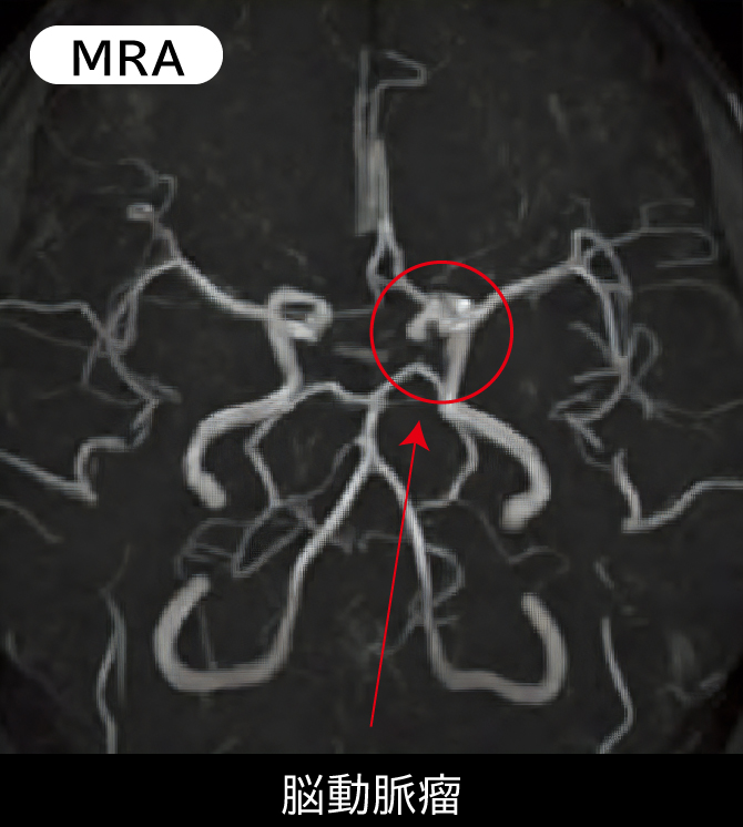 山梨県厚生連健康管理センター