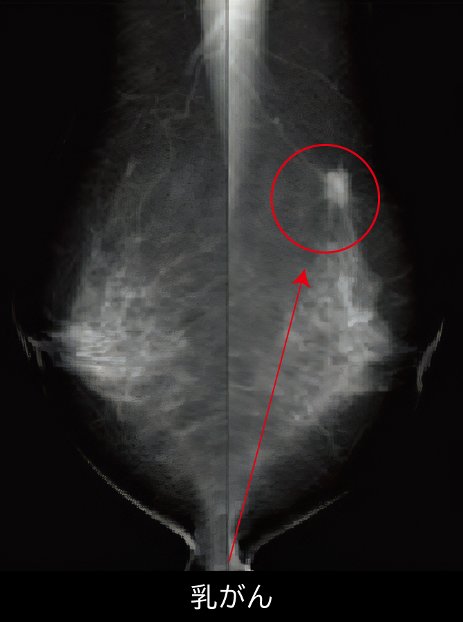 山梨県厚生連健康管理センター