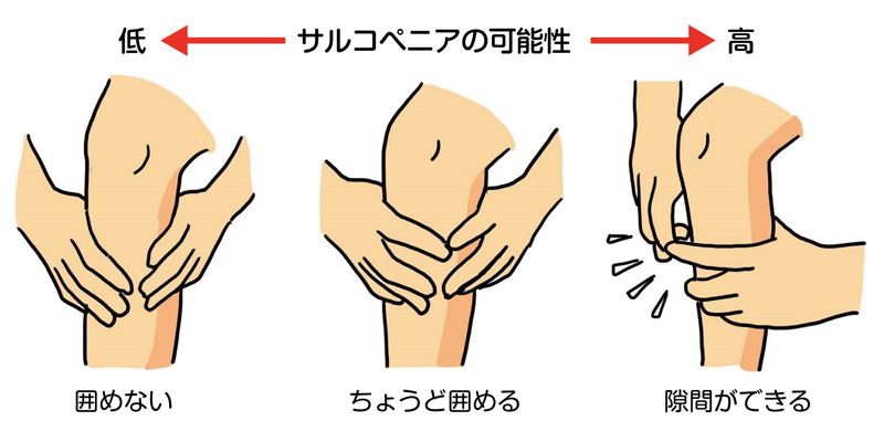 指輪っかテスト 健康長寿 サルコペニア
