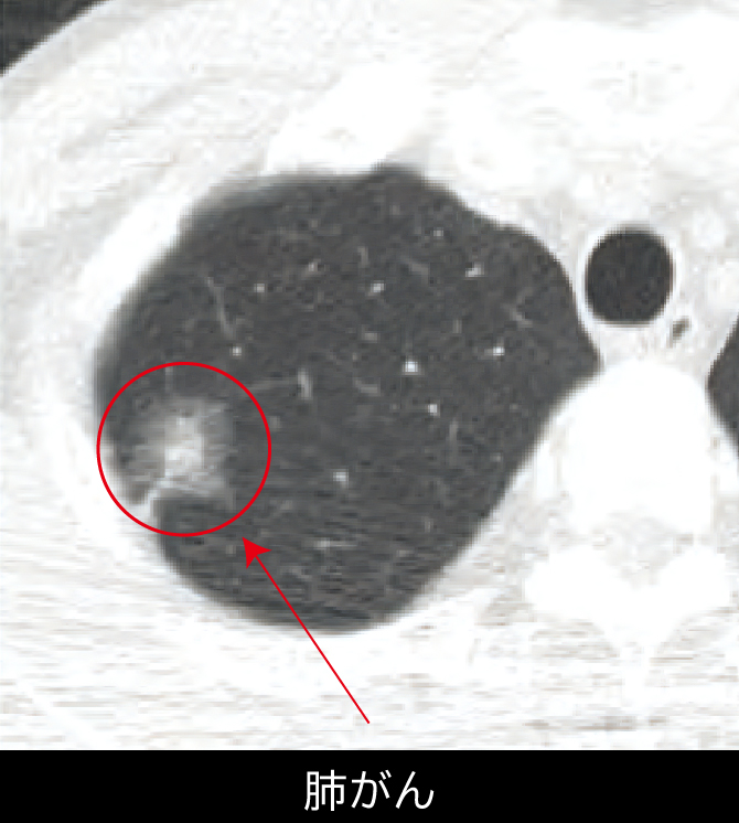 山梨県厚生連健康管理センター