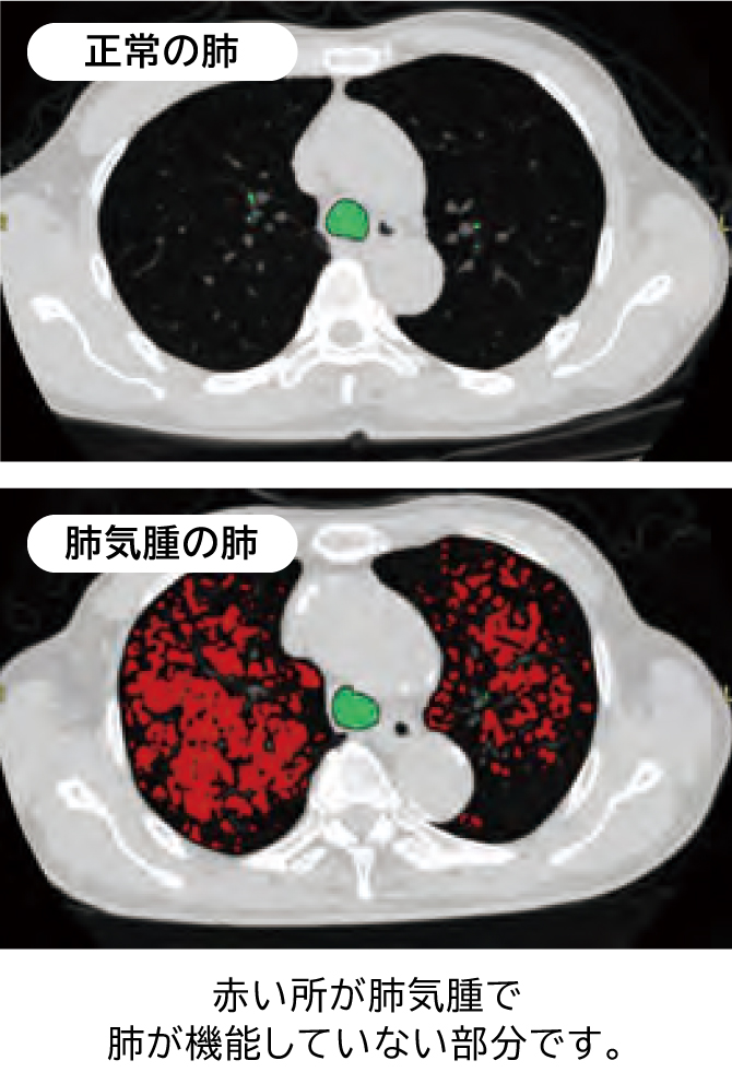 山梨県厚生連健康管理センター