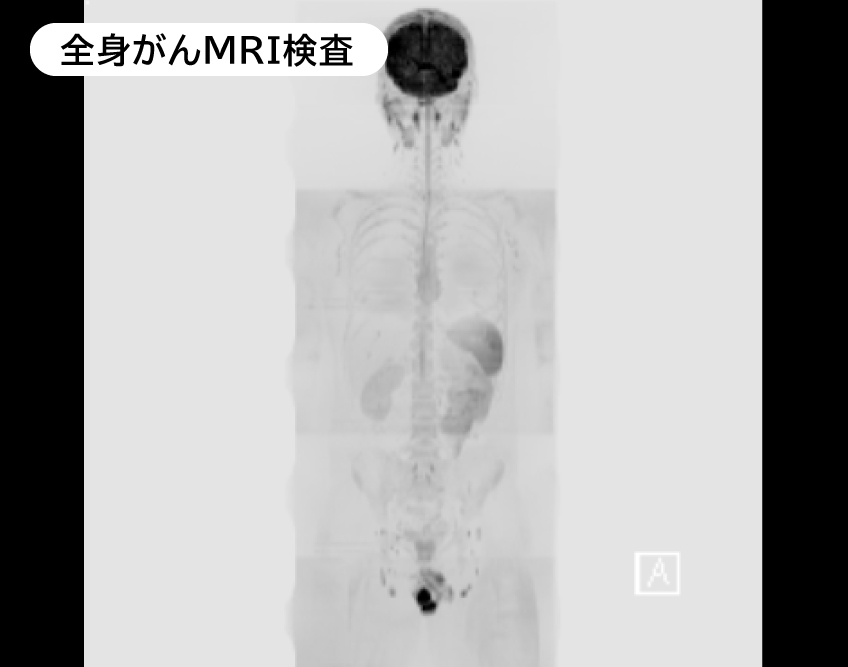 山梨県厚生連健康管理センター